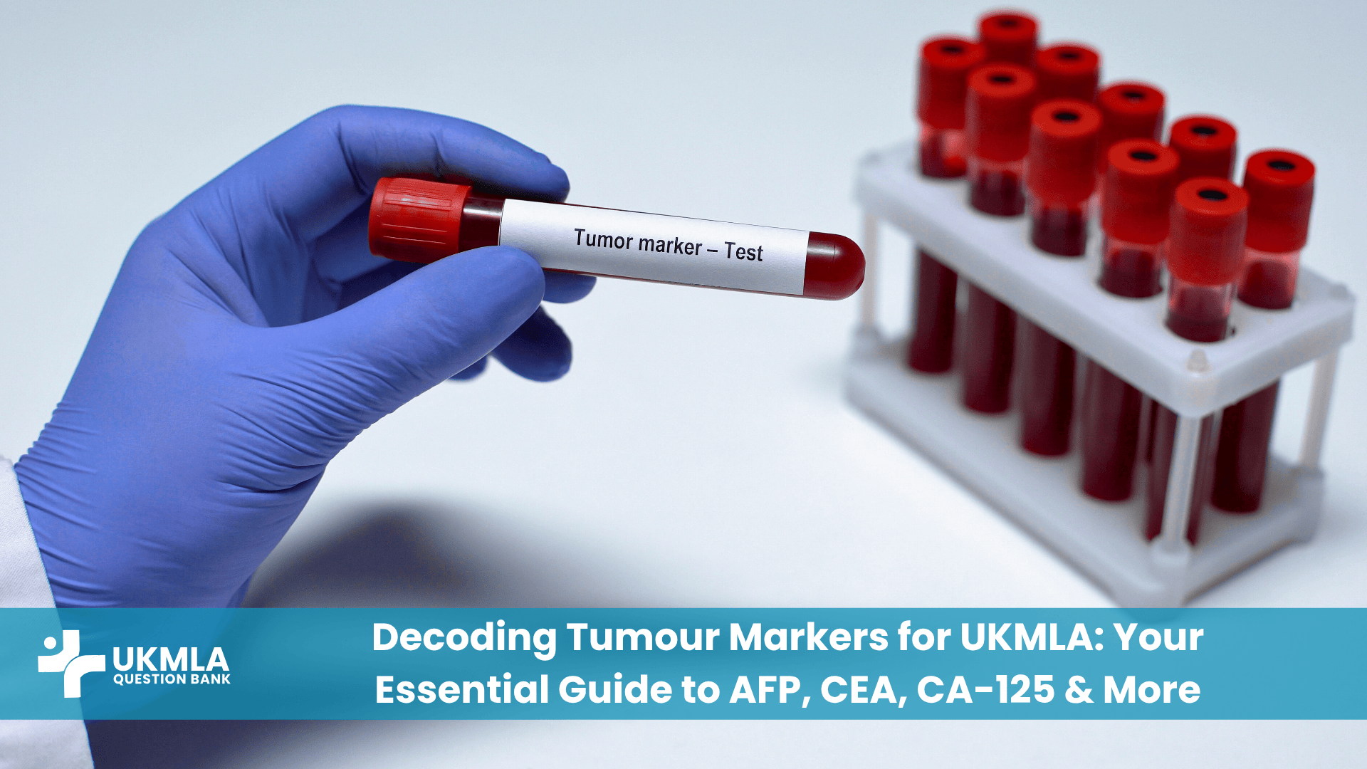 Doctor reviewing results in guide to tumour markers interpretation UKMLA.